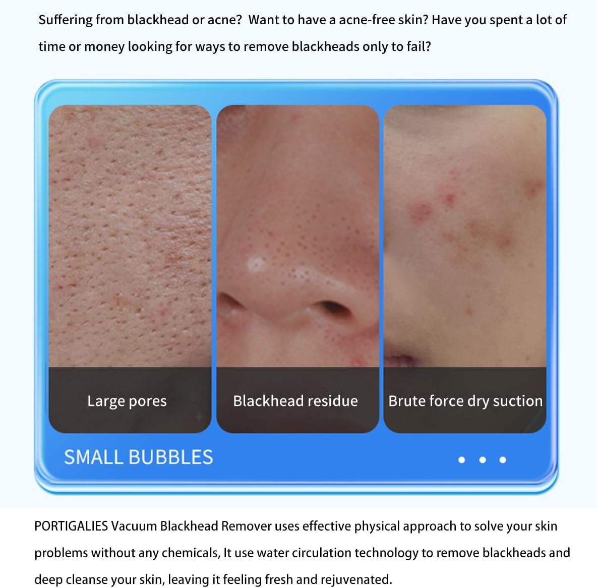 Black Head Remover
