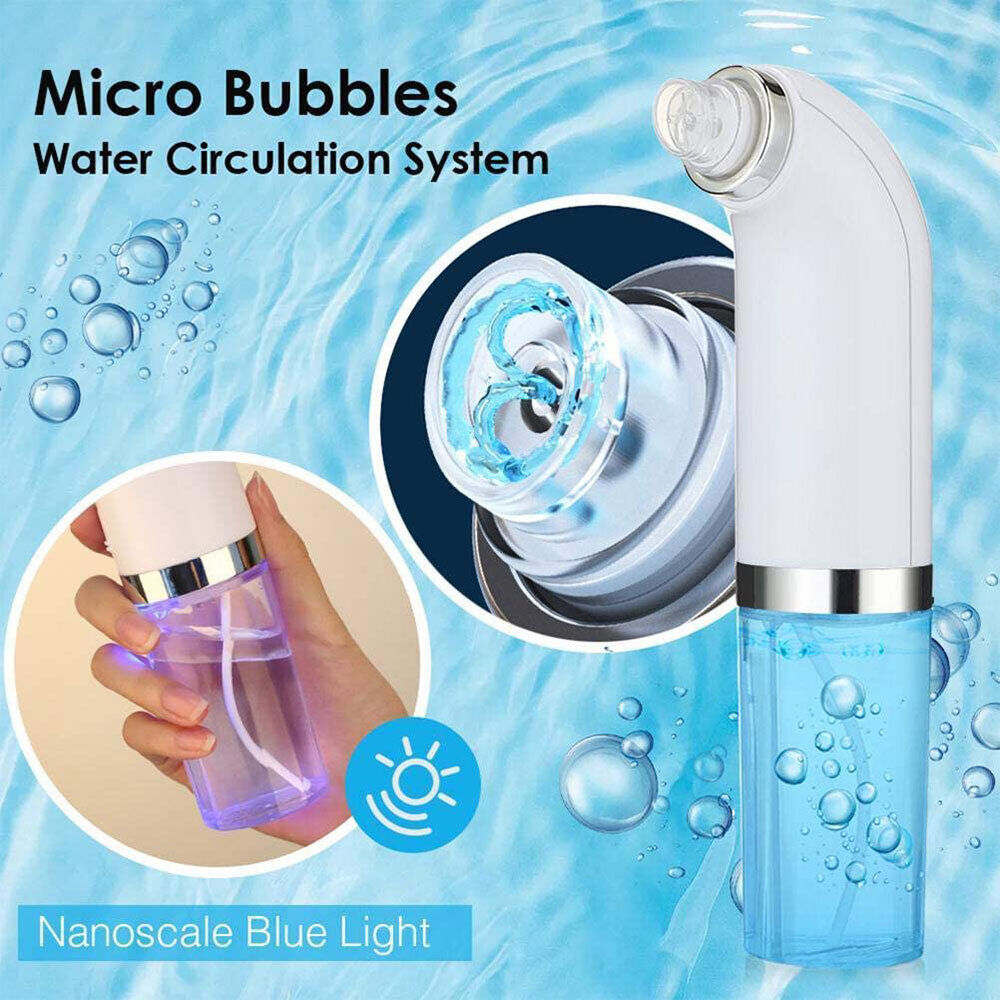 Black Head Remover