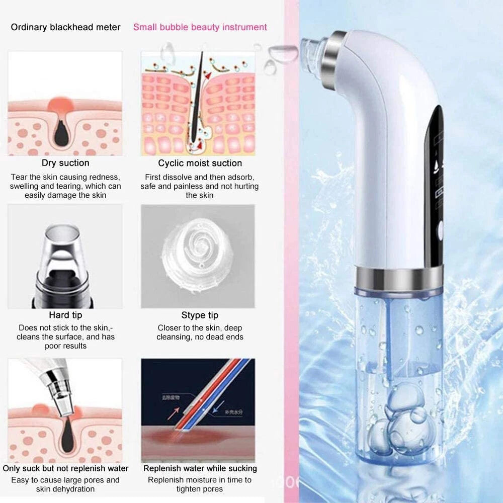Black Head Remover
